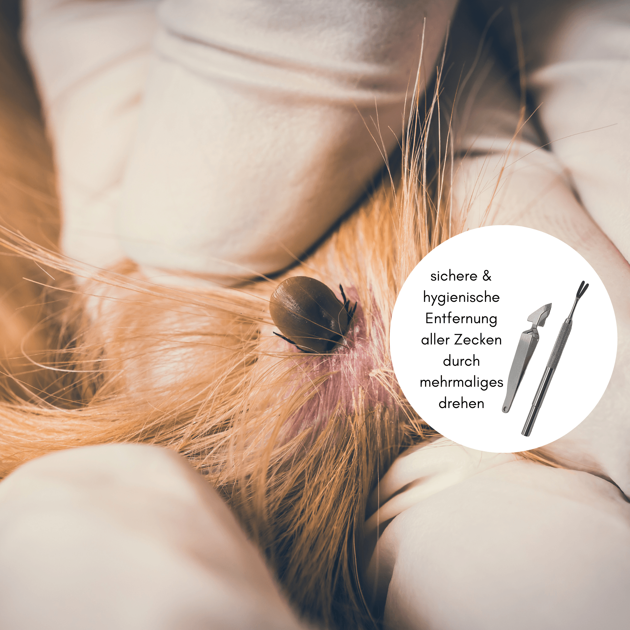 Zeckenzange und Zeckenhaken aus Edelstahl im Set